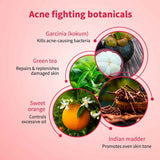 Ayouthveda Acne Enemy Face Wash Gel For Acne & Pimples (Net Qty-100 ml)