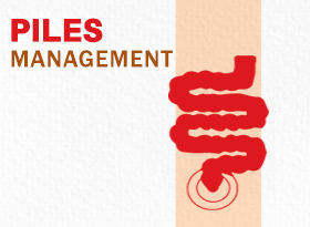 Piles Management